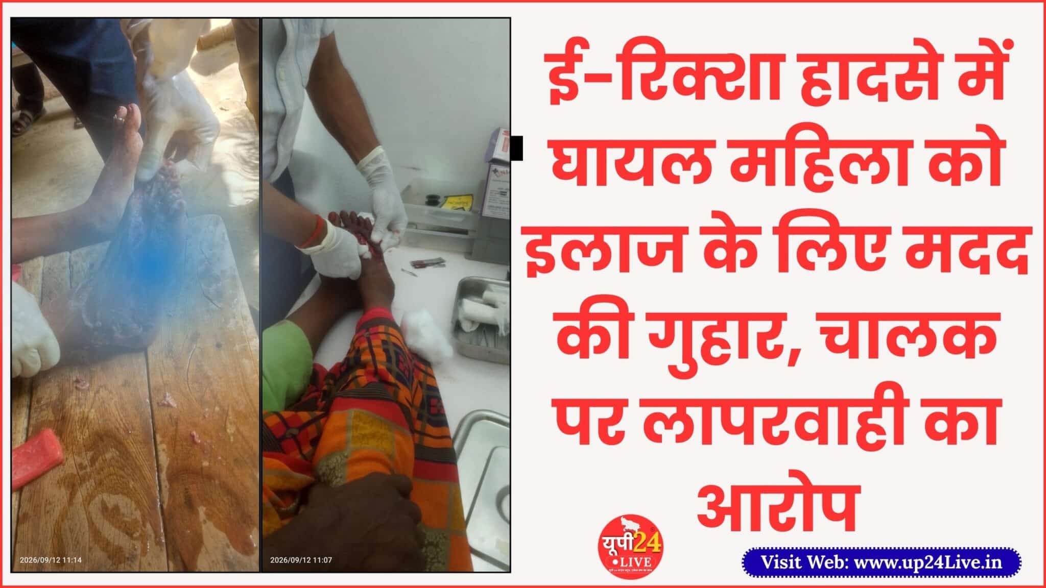 Home 63 Hardoi News: e-riksha hadse mein ghayal mahila ko ilaaj ke liye madad ki guhar, chalak par laparvahi ka arop Hardoi News: uttar pradesh ke hardoi jile ke kachhauna thana kshetra mein e-riksha durghatna mein ghayal hui ek mahila ke parijanon ne ilaaj aur nyay ke liye madad ki guhar lagai hai. peedit parivar ka aarop hai ki hadse ke baad e-riksha chalak ne ilaaj karane ka bharosa diya, lekin baad mein ilaaj ka kharch uthane se inkar kar diya. pidit parivar ke anusar, vijay kumar nivasi gram mehandi majra, bhanpur post hathoda, thana kachhauna, jila hardoi ne bataya ki unki maa rampyari sadak aur highway par saf-safai ka kaam karti han. parijanon ke mutabik, 11 september 2026 ki sham kareeb 6:30 se 7 baje ke beech rampyari duty puri karne ke baad e-riksha se balamau se hathauda ki or ghar laut rahi thin. parivar ka kehna hai ki e-riksha mein kareeb chhah log sawar the aur use chalak sachin chala raha tha. Hardoi News: bhainse se takraane ke baad palat gaya e-riksha vijay kumar ke anusar, e-riksha kathit roop se tej gati aur laparvahi se chalaya ja raha tha. isi dauran e-riksha ek bhainse se takra gaya aur palat gaya. hadse mein rampyari aur unke bhanje shyam ko gambhir choten in. parijanon ke mutabik, hadse ke baad mauke par maujood ek vyakti ne ambulance ko phone kiya. ghayalon ko swasthya kendra kachhauna le jaya gaya, jahan se rampyari ko jila aspataal hardoi refer karne ki baat kahi gai. parivar ka kehna hai ki iske baad unhone rampyari ka ilaaj niji aspataal mein karane ka faisla kiya. aarop hai ki us samay e-riksha chalak sachin ne ilaaj ka kharch uthane ki baat kahi thi. Hardoi News: ilaaj karane se inkar karne ka arop vijay kumar ka aarop hai ki jab unki maa aspataal mein bharti thin, tab unhone e-riksha chalak se aspataal aakar ilaaj mein madad karne ka anurodh kiya. parivar ke mutabik, chalak ne baad mein ilaaj karane se inkar kar diya. parijanon ka kehna hai ki unhone 14 september 2026 ko kachhauna thane mein shikayat di. iske baad 17 september 2026 ko e-riksha chalak sachin ke ghar jaane aur donon pakshon ko thane bulaye jaane ki baat parivar ne batai. vijay kumar ke anusar, unki maa gambhir roop se ghayal hone ke bavjood do logon ki madad se thane pahunchin. unka dawa hai ki thane mein kai ghante tak baatcheet hui, lekin ilaaj ke kharch ko lekar koi samadhan nahin nikla. Hardoi News: police par bhi lagaye gambhir arop pidit parivar ne police par bhi gambhir aarop lagaye han. vijay kumar ka kehna hai ki unhen aashanka hai ki e-riksha chalak ne policekarmiyon ko paise diye honge. halanki, is aarop ki swatantra pushti nahin hui hai aur police ka paksh is mamle mein samne aana baaki hai. parivar ka kehna hai ki unki maa ko durghatna mein gambhir choten aai hain aur ilaaj ka kharch uthana unke liye mushkil ho raha hai. unhone sambandhit adhikariyon se mamle ki nishpaksh jaanch karane, durghatna ki jimmedari tay karne aur ghayal mahila ke ilaaj mein aarthik madad dilane ki mang ki hai. parivar ne UP tak news se lagai madad ki guhar pidit parivar ne UP tak news se mamle ko samne laane aur sambandhit prashasan tak apni awaz pahunchaane ki appeal ki hai. parivar chahta hai ki durghatna ki jaanch karakar doshi paye jaane wale vyakti ke khilaf niyamanusaar karvai ki jaye aur ghayal rampyari ke ilaaj mein sahayata uplabdh karai jaye. not: is mamle mein e-riksha chalak sachin aur kachhauna police ka paksh uplabdh hone par use bhi khabar mein shamil kiya jana chahiye. durghatna, chalak ki laparvahi, ilaaj se inkar aur police se jude aaropon ki pushti adhikarik dastavegon, fir, medical record, pratyakshdarshiyon aur police ke bayan se ki jaani chahiye. 3,217 Hardoi News: Plea for help to treat woman injured in e-rickshaw accident; driver accused of negligence